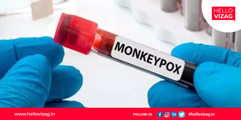 A 22-year-old Vizag medical student who tested negative for monkeypox was discharged